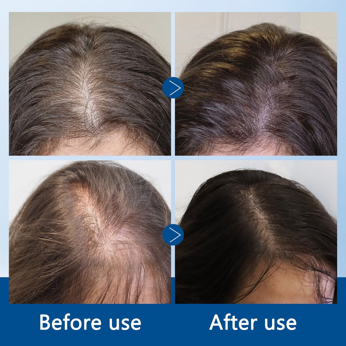 Juxek Hair Growth Nutritive Root Rolling Ball Essence Liquid