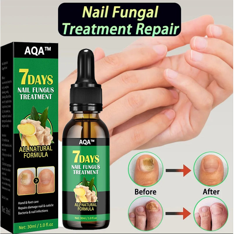 🚀Best - seller alert! AQA™ Ginger Nail Repair Series. Free shipping to your home for orders over 3 items 🚚, with up to 70% price cut 💰. A must - have for nail care!