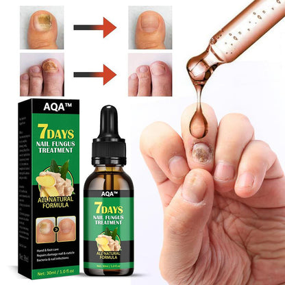 🚀Best - seller alert! AQA™ Ginger Nail Repair Series. Free shipping to your home for orders over 3 items 🚚, with up to 70% price cut 💰. A must - have for nail care!