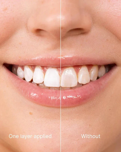 SmileFitPro™ Instant Smile Enhancer – Natural, Fast, and Gentle Teeth Whitening