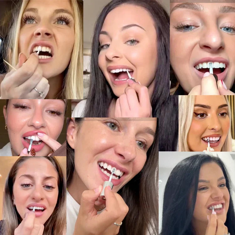 SmileFitPro™ Instant Smile Enhancer – Natural, Fast, and Gentle Teeth Whitening
